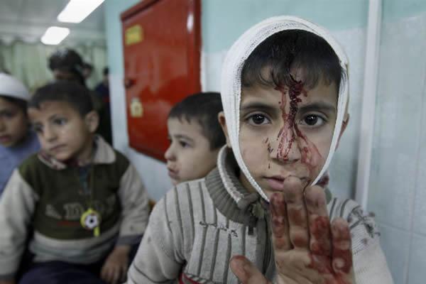 Los niños han sido una de las grandes víctimas del criminal ataque de las fuerzas israelíes en la Franja de Gaza. Foto: http://www.socialismo21.org/